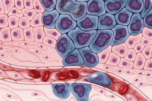 cancer cells